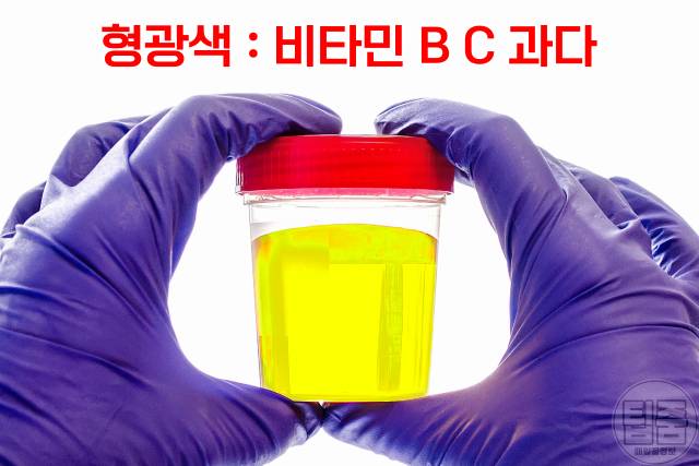 소변색깔 건강상태,형광색 비타민c 비타민b,소변색깔이 뿌옇다