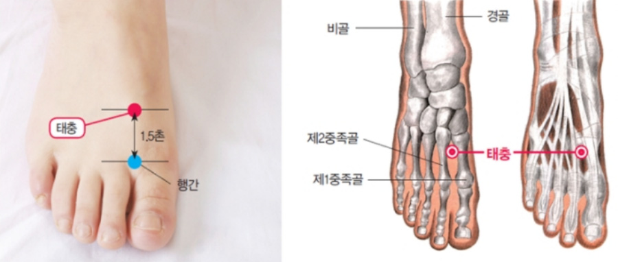 인체의 365혈 중에서 발등에 위치를 한 태충혈의 위치를 나타낸 그림과 해부학적인 위치를 나타낸 그림을 같이 나열을 한 사진