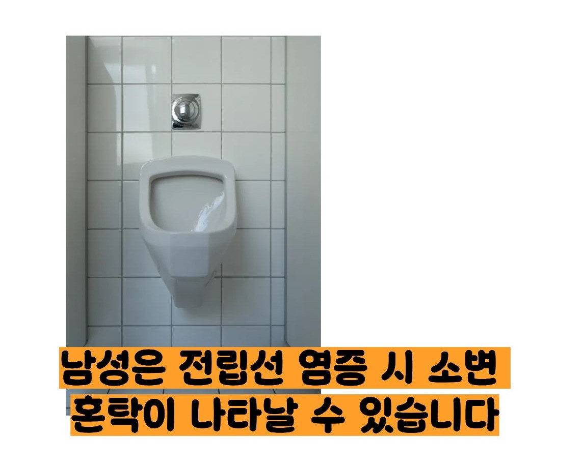 오줌이 탁한이유