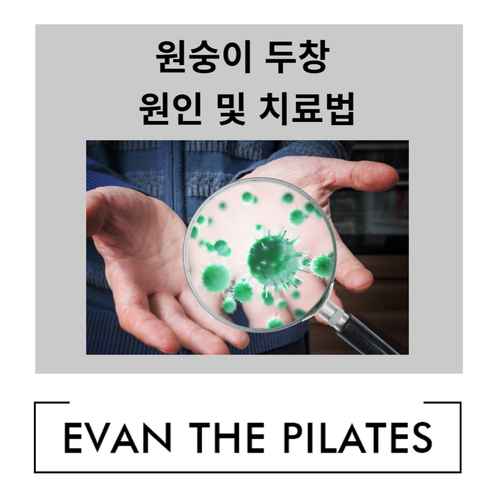 원숭이 두창