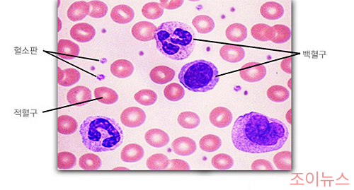 철분 검사, 혈액의 구성_이미지출처:국가건강정보포털
