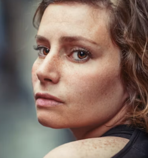 눈밑 지방재배치 수술비용 회복기간 부작용 수술방법