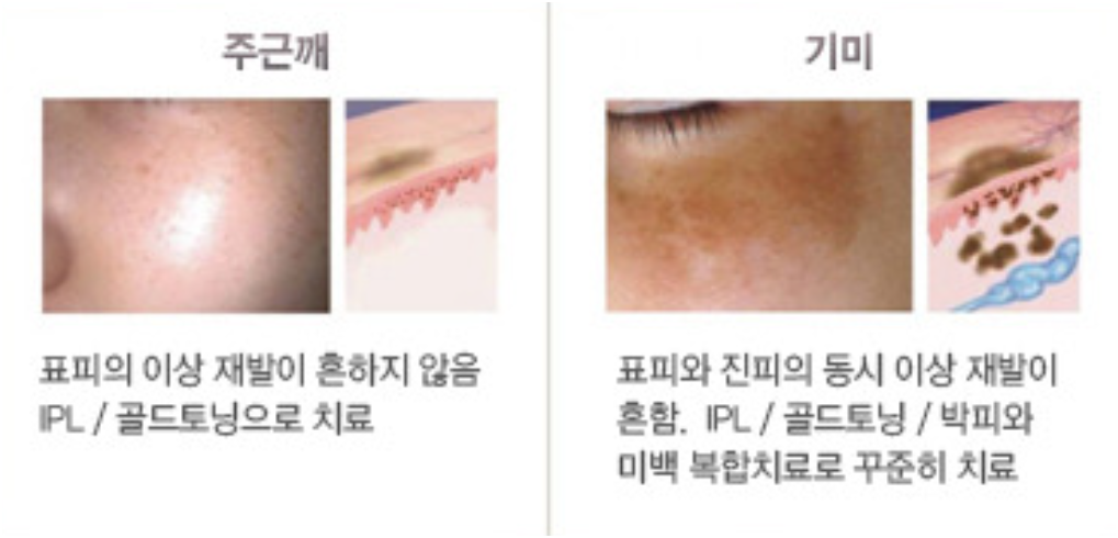 치료법
