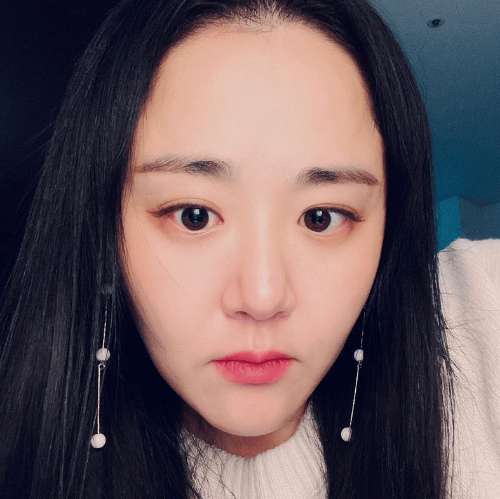 문근영 GV 불참