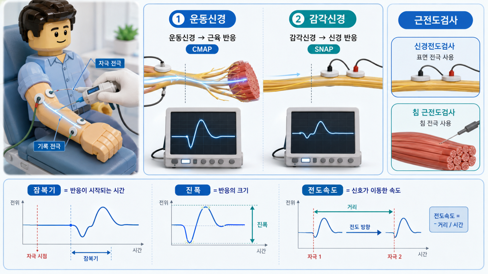 신경전도검사의 잠복기·진폭·전도속도와 운동신경·감각신경 측정 원리를 설명하는 의료 인포그래픽