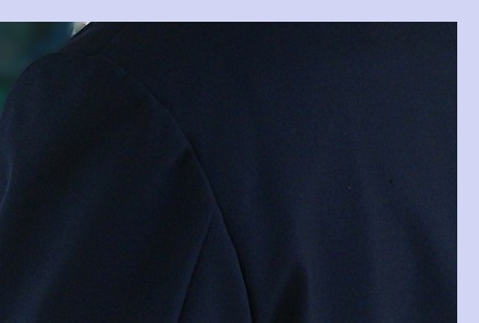 대상포진 초기증상