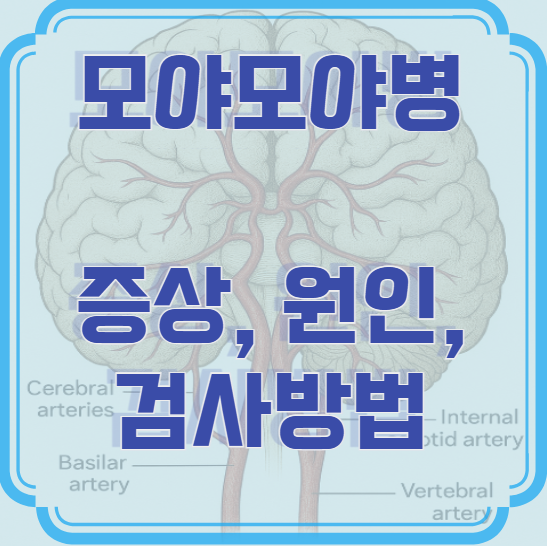 모야모야병 증상, 원인, 검사방법
