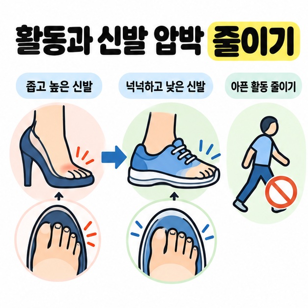 앞볼이 좁고 굽이 높은 신발과 앞볼이 넉넉하고 굽이 낮은 신발의 발가락 공간을 비교하고 아픈 활동 줄이기를 표시한 그림