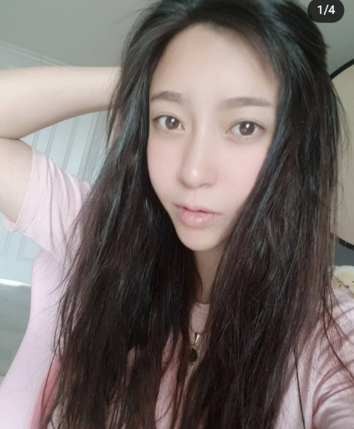 bj 임블리 사망 원인 향년 37세