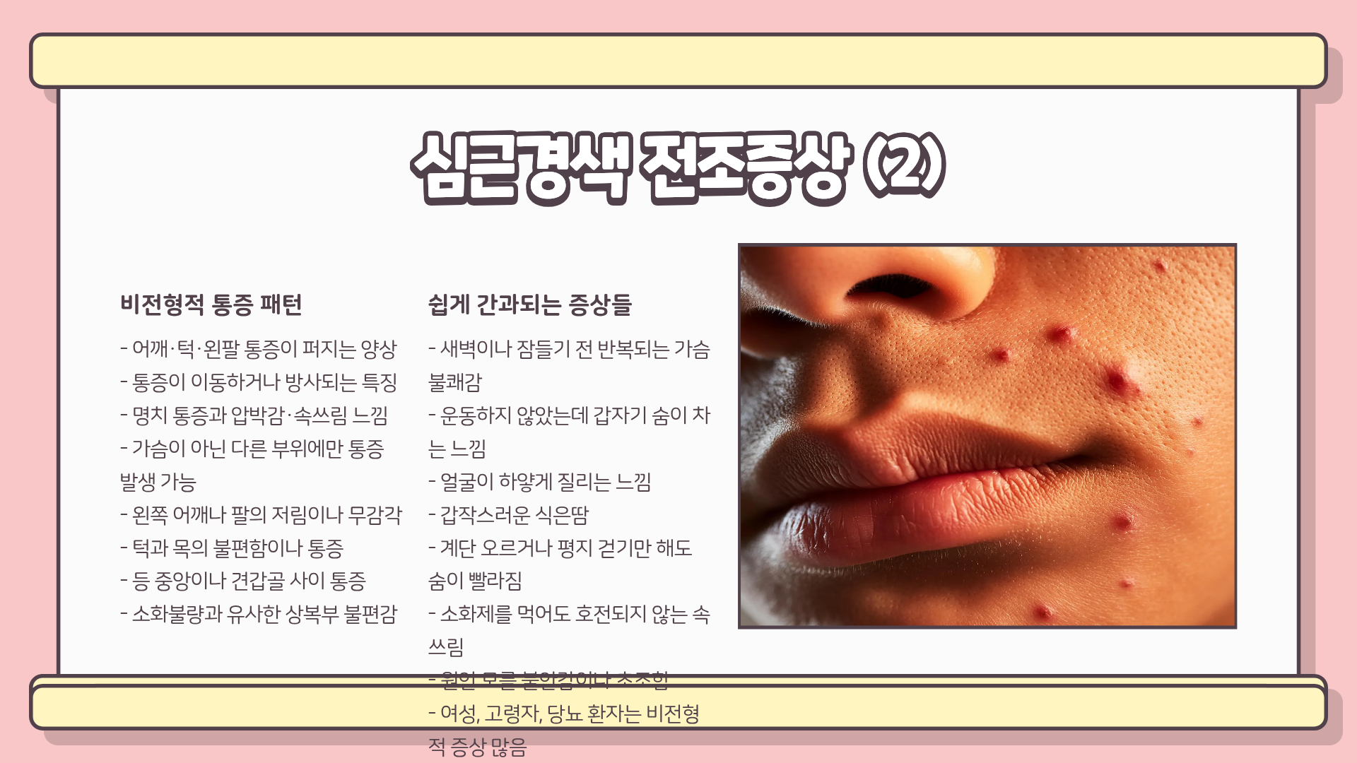 심근경색이란? 심근경색 전조증상 &amp;#124; 심근경색 초기증상 &amp;#124; 심근경색 원인 총정