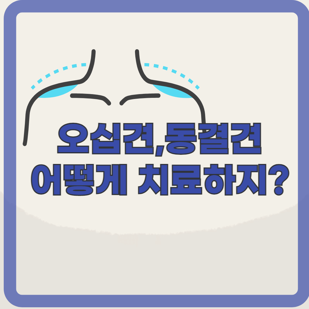 어깨 통증으로 힘들다면? 오십견(동결견) 의심해 봐야
