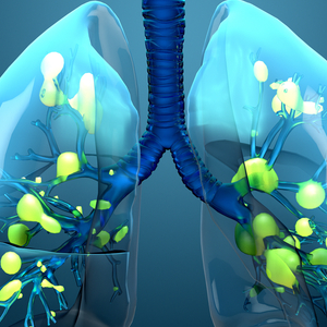 미국 폐렴 진단키트 관련주 대장주 테마주 TOP5