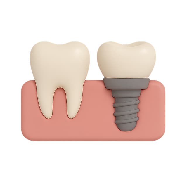 임플란트 수명을 결정하는 숨은 부품, '커스텀 어버트먼트' 완벽 가이드