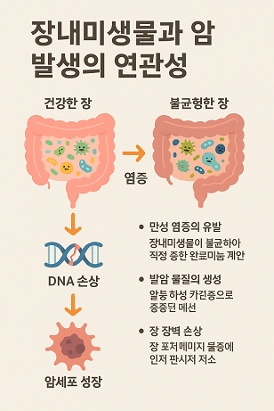 장내미생물과 암 발생의 연관성 관련 사진