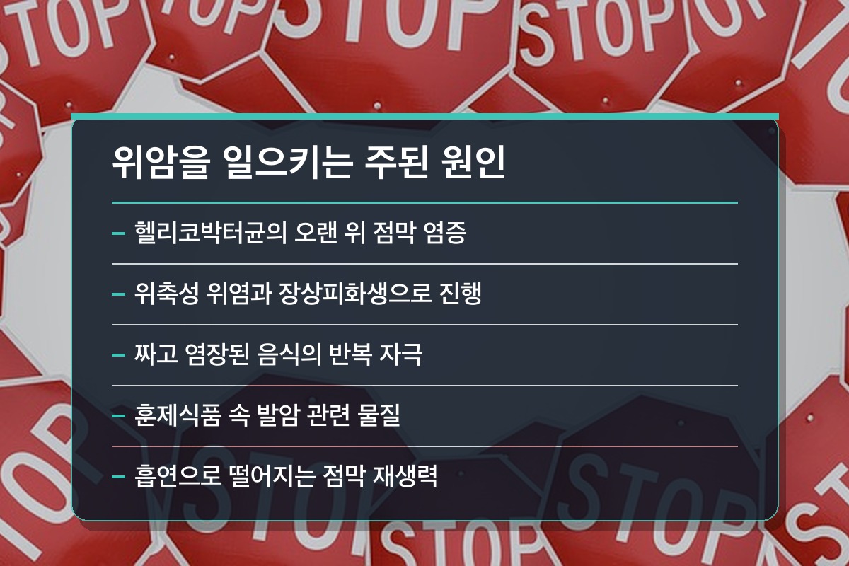 위암 초기증상 위암을 일으키는 주된 원인