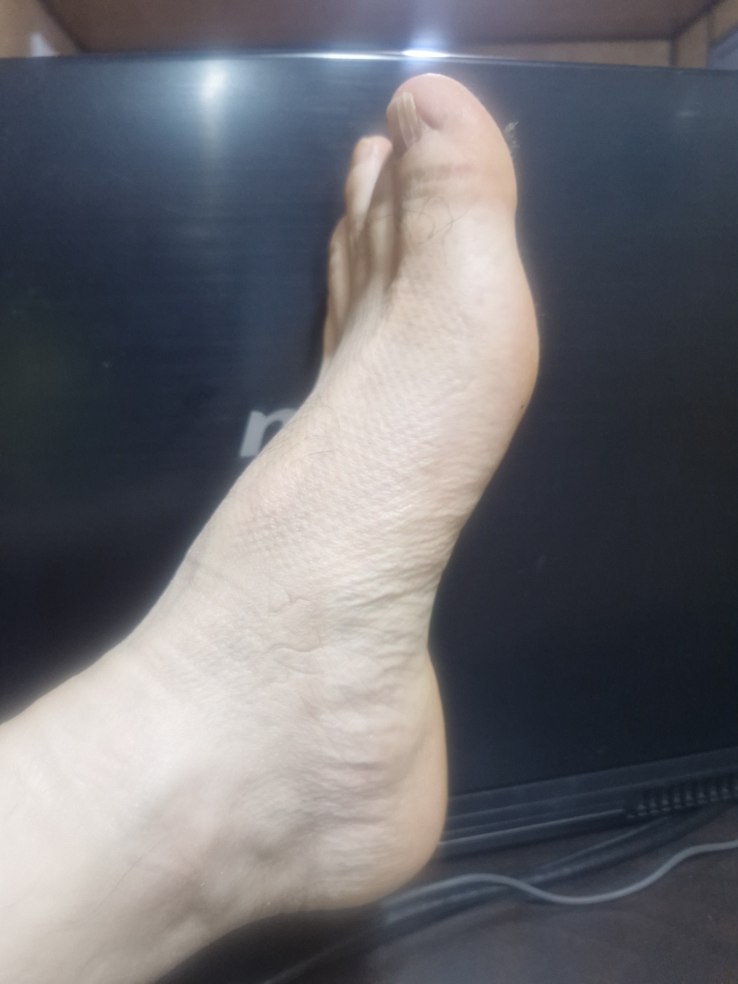 몸이 말하는 간기능 이상 체크하는 법