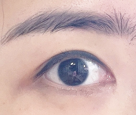 눈