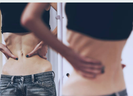 영양 부족 탈모