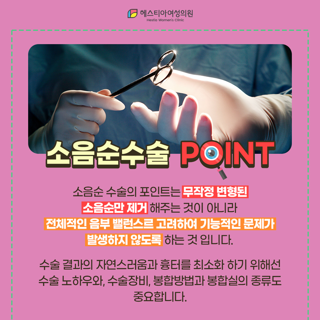 소음순수술포인트