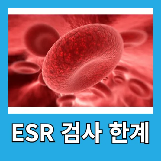 ESR 검사의 한계