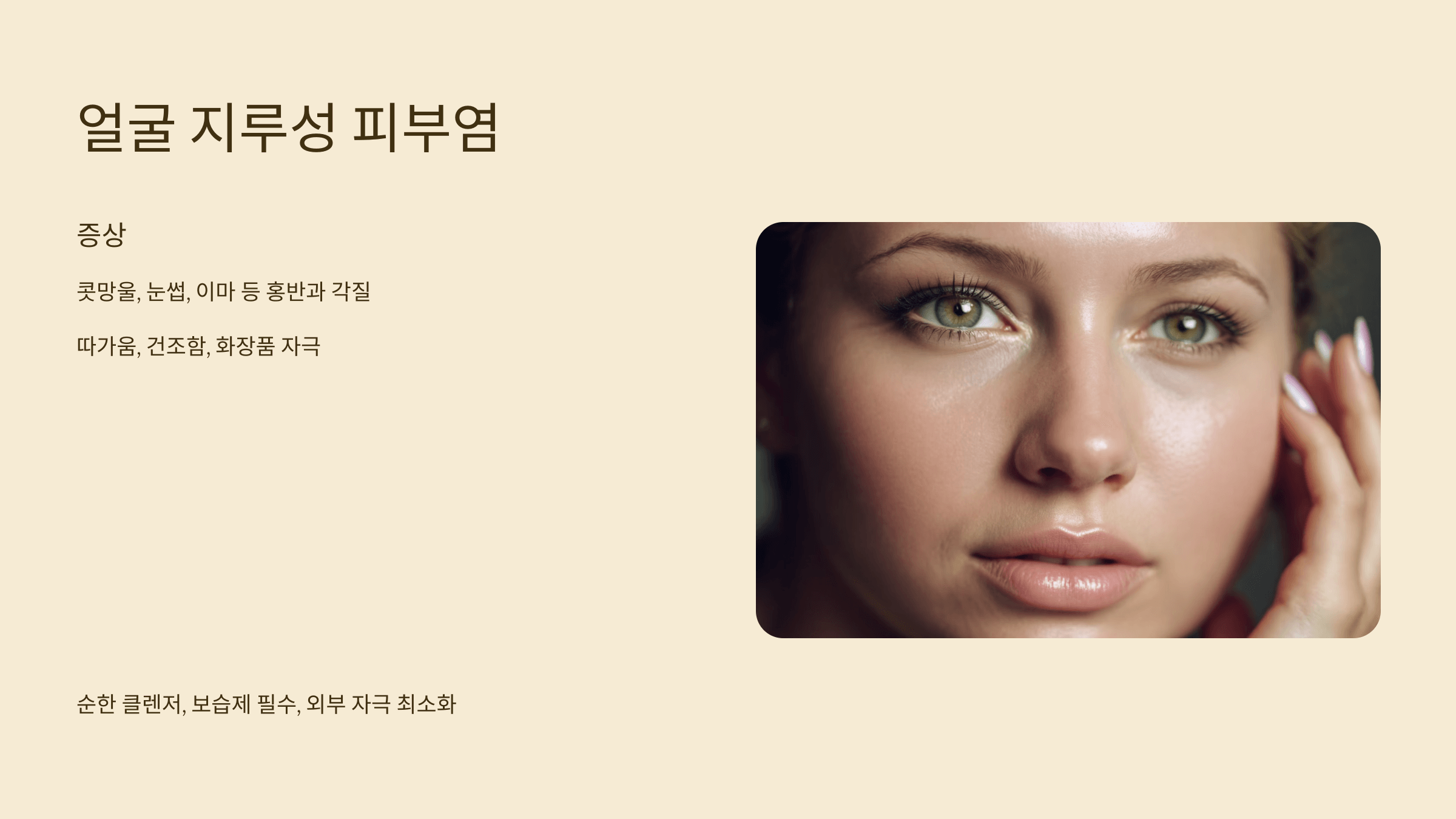 얼굴지루성 피부염