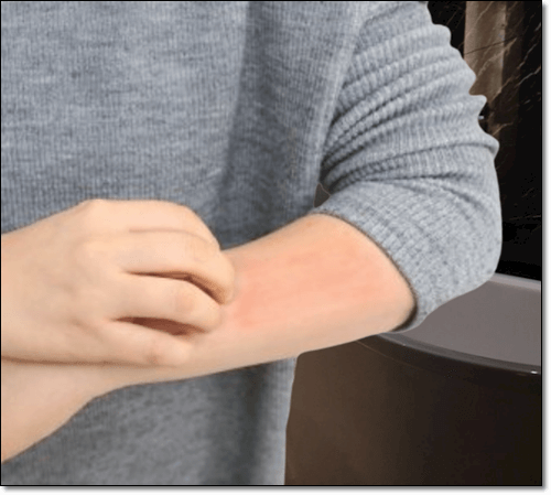 알레르기로 가려운 남성