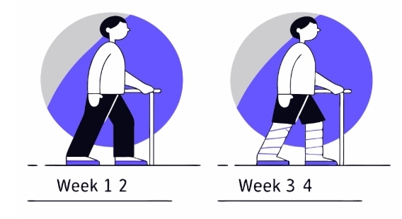 위암 수술후 관리방법