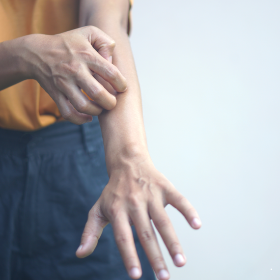 건선, 평생을 함께하는 만성 염증 질환