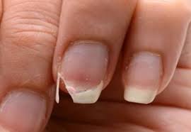 손톱이 잘 부러지는 이유