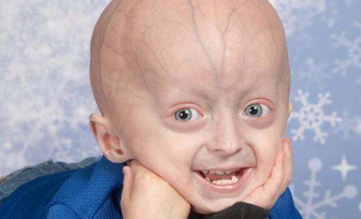 소아조로증 자주 묻는 질문 FAQ