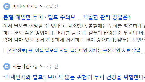 봄철 탈모 관련 뉴스 기사들
