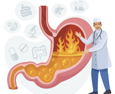 역류성 식도염 증상 자연치료 방법 좋은 음식 총정리