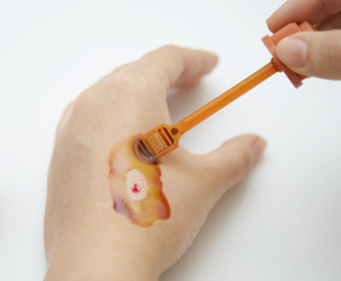 두피 찢어지거나&amp;#44; 어디에 찍혀서 머리에서 피날 때 대처법