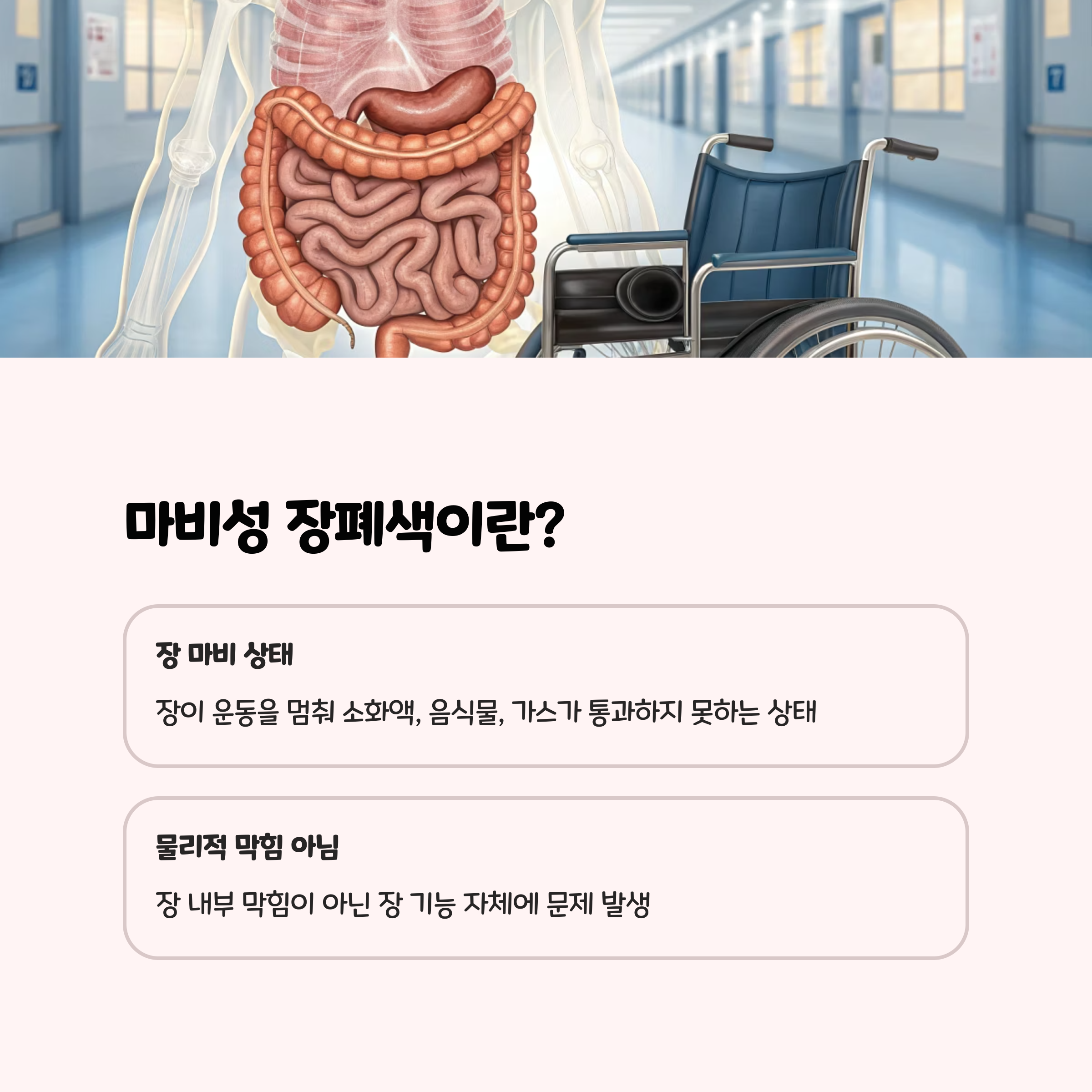마비성 장폐색, 도대체 뭔가요?