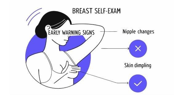 유방암1기 치료과정