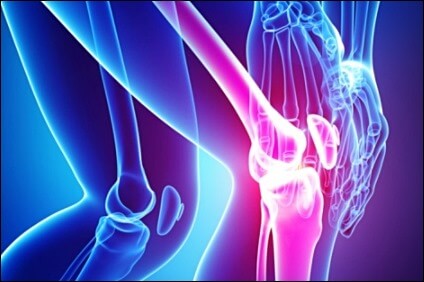 관절염에 좋은 운동 2