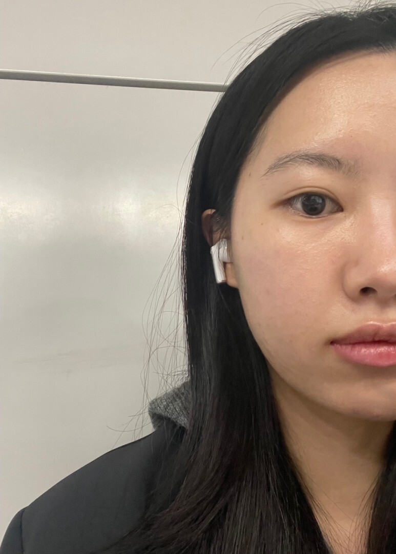 온다 리프팅 후기