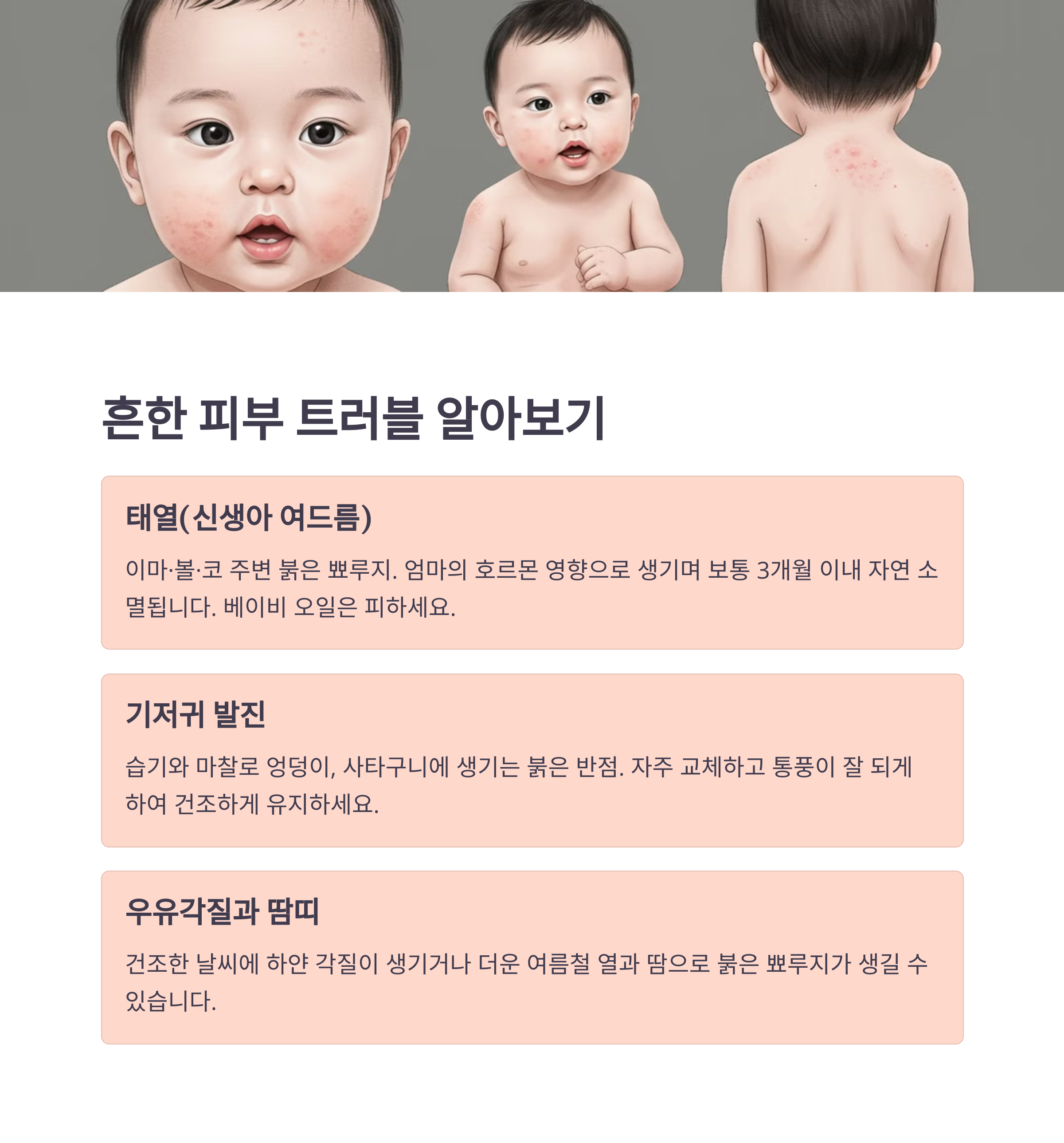 아기의 볼, 이마, 코 주변에 붉은 뾰루지 같은 것이 생긴 현상의 사진
