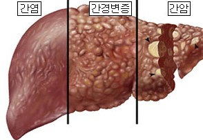 ㄴ