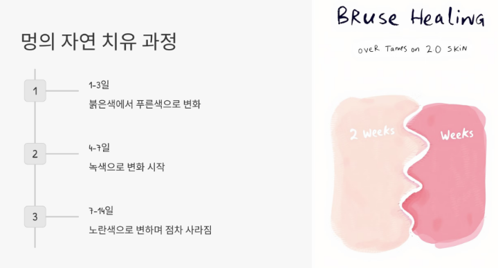 멍 빨리 빼는 계란보다는 연고 쓰는 게 훨씬 빠름