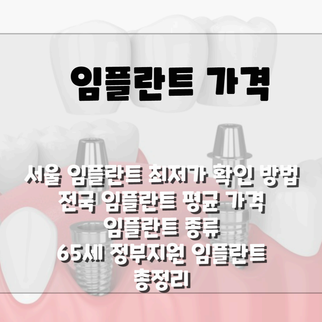 임플란트 가격, 전국 최저가 임플란트 가격 확인 블로그 썸네일 사진