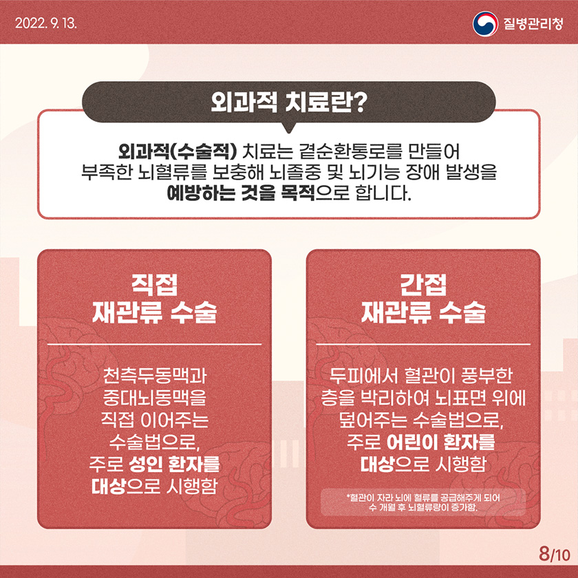 모야모야병 유전 증상 원인 치료 수술