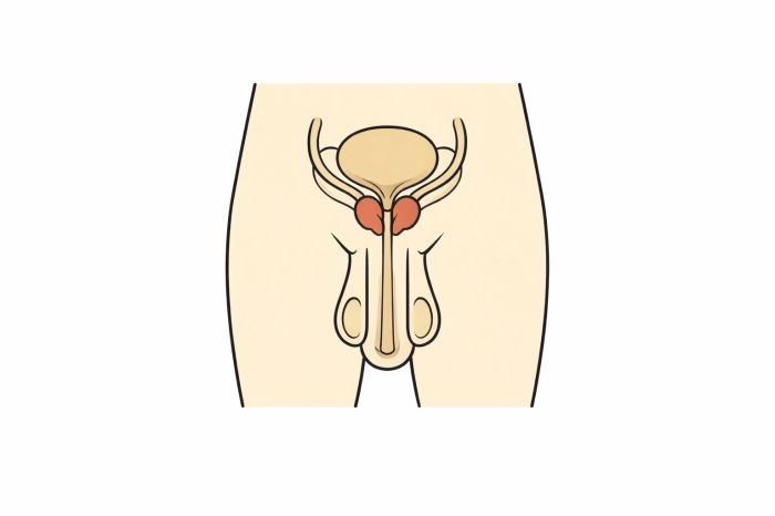 암환자 산정특례 제도
