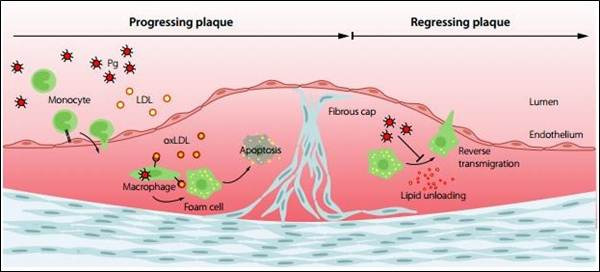 구강 건강 관리로 심혈관 질환과 치매를 예방하는 방법 관련 이미지