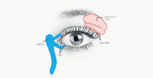 안구 건조증 초기증상