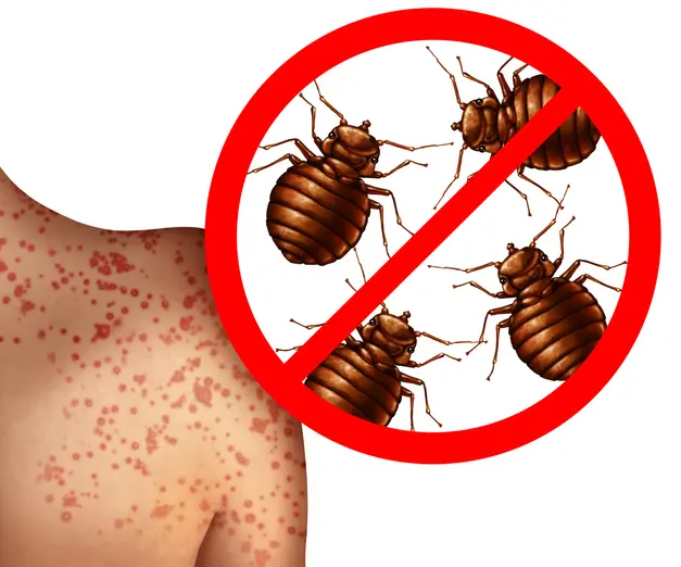 빈대 예방법
