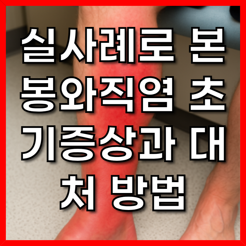 실사례로 본 봉와직염 초기증상과 대처 방법