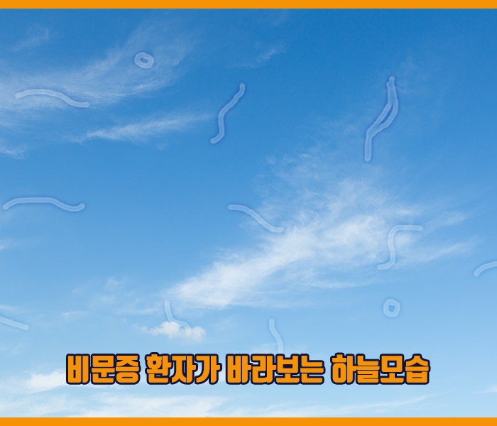 비문증 환자가 바라보는 하늘모습