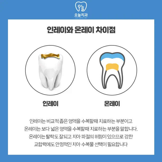 인레이 온레이의 차이와 치료 방법_3