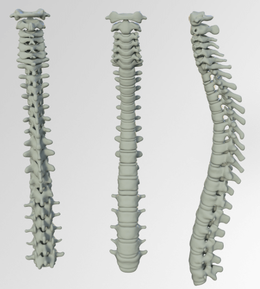 척추 시술 후 관리가 중요한 이유